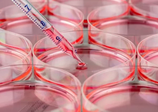 Ujian Kultur Darah (Blood Culture Test)