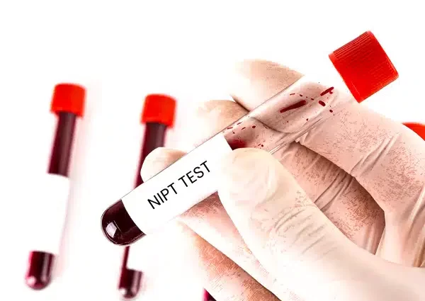 NIPT Test (Non-Invasive Prenatal Testing)