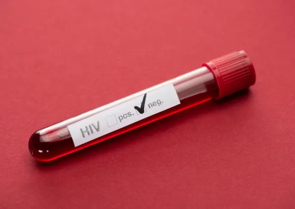 negative hiv blood sample test on red background 2026 01 06 00 08 31 utc